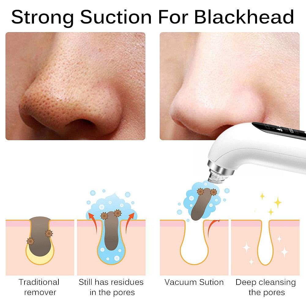 USB RECHARGEABLE BLACKHEAD REMOVER